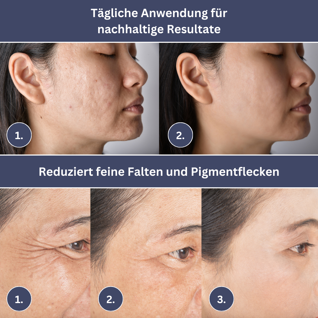 Hautpflegende LED-Gesichtsmaske