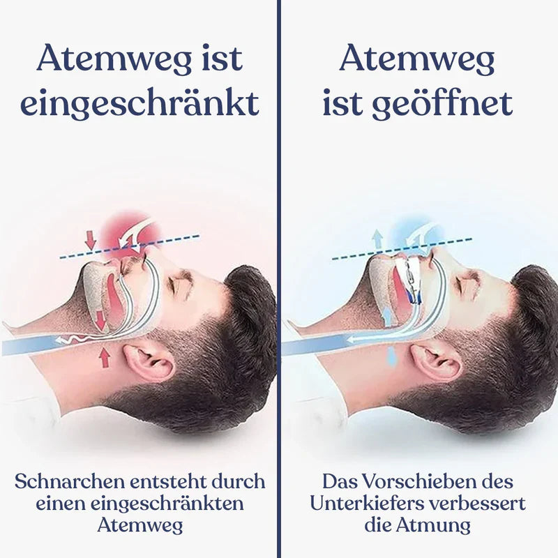 ALL-IN-ONE ANTI-SCHNARCH-SCHIENE (ZAHNSCHUTZ)